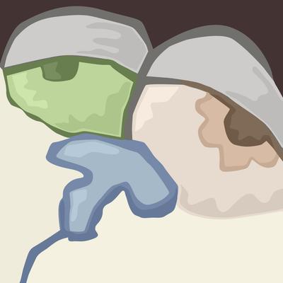 Avatar for Popoyipopo